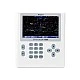 Bresser Комплект Телескоп и аксесоари SXD2-SD103S