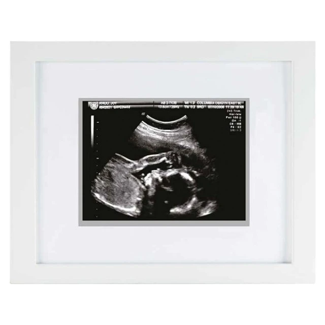 Pearhead Videozone Photo Frame - White
